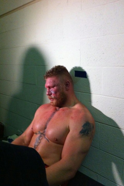 Brock Lesnar After UFC 121