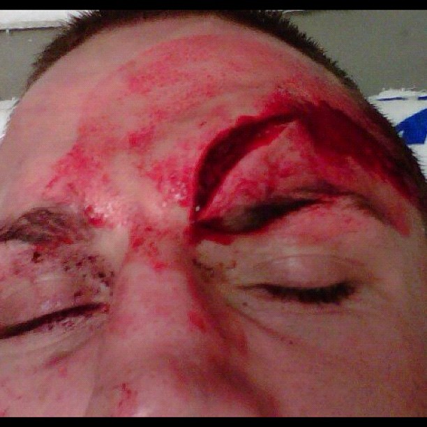 Eddie Wineland's Cut from UFC on FX